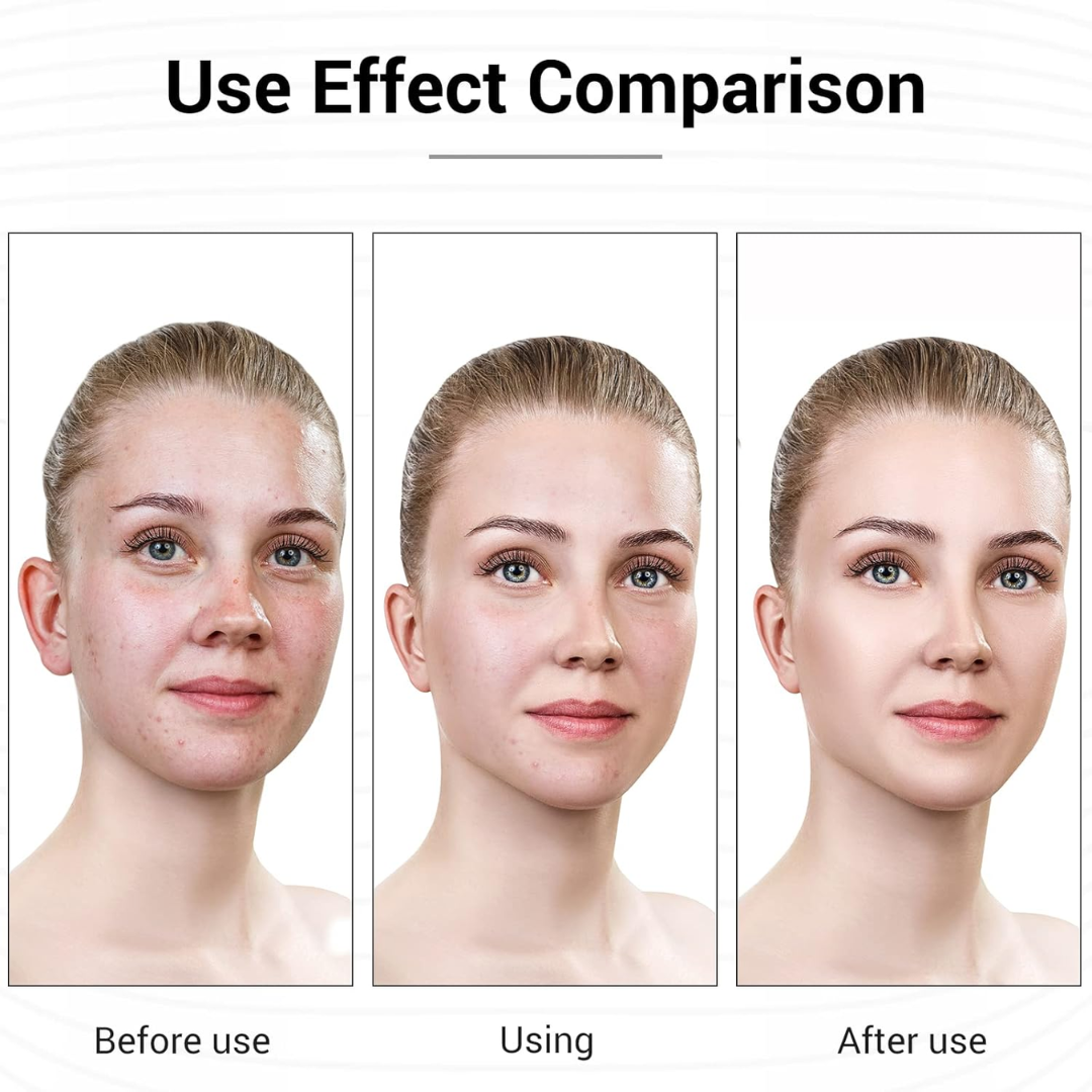 Led skin therapy mask